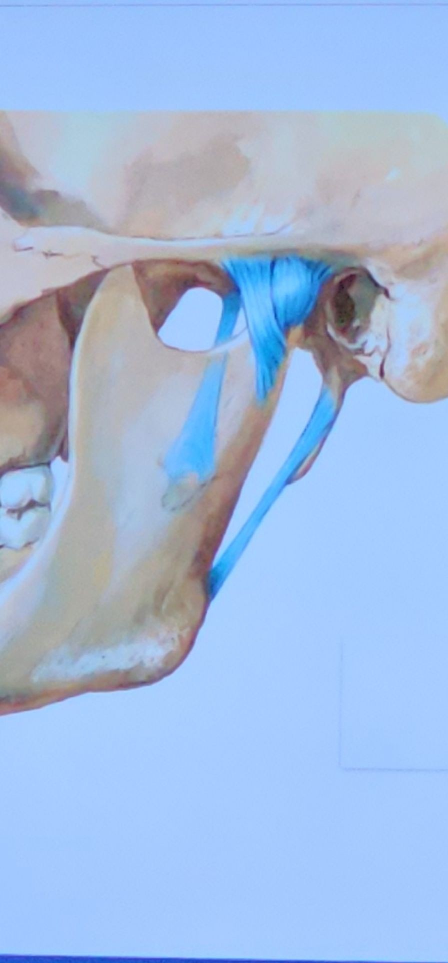 👉 Terapija viličnog zgloba /Temporomandibular joint (TMJ) therapy