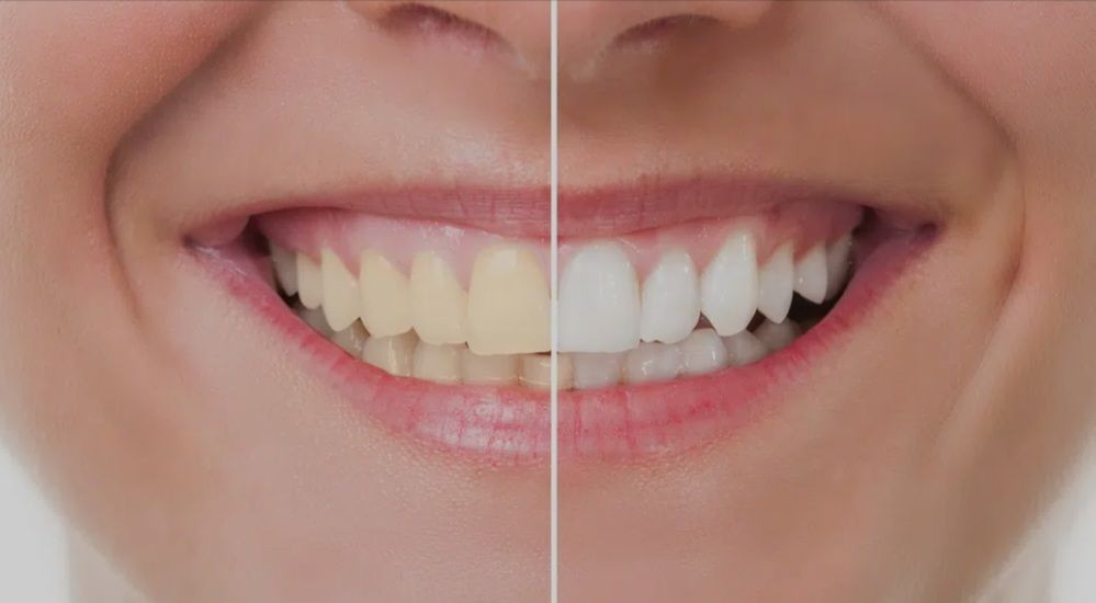 👉 Estetska stomatologija /Cosmetic Dentistry