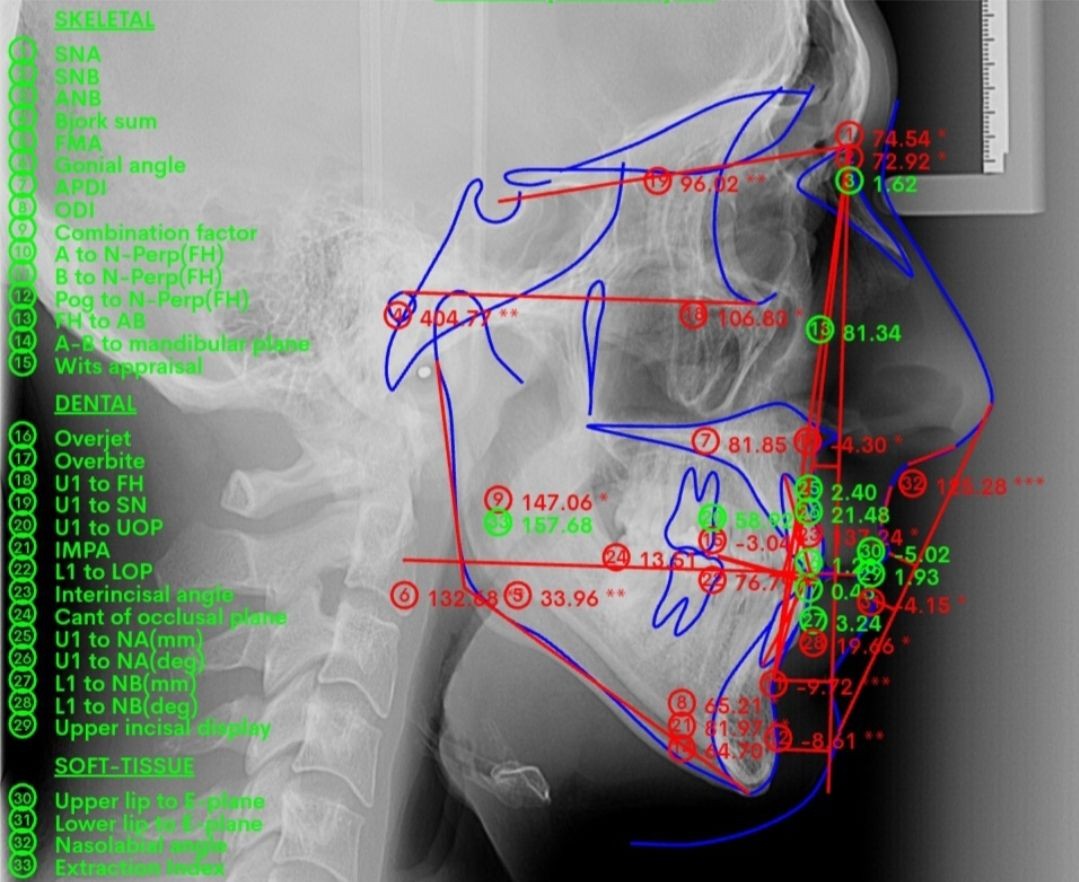 👉 Planiranje ortodontskog tretmana / Orthodontic treatment planning